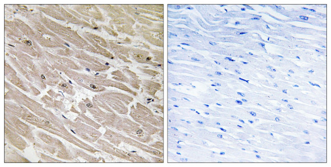 MRPL46 Antibody in Immunohistochemistry (Paraffin) (IHC (P))