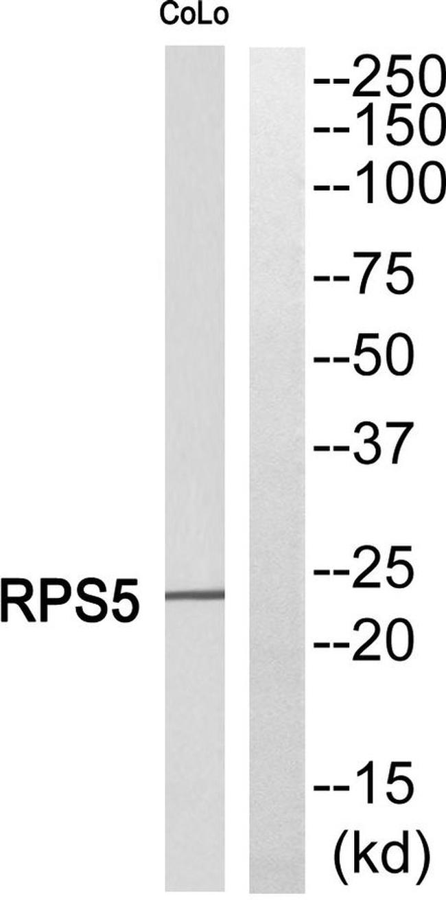 RPS5 Antibody in Western Blot (WB)