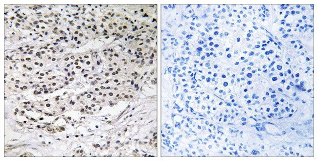 CEP131 Antibody in Immunohistochemistry (Paraffin) (IHC (P))