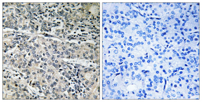 MP68 Antibody in Immunohistochemistry (Paraffin) (IHC (P))