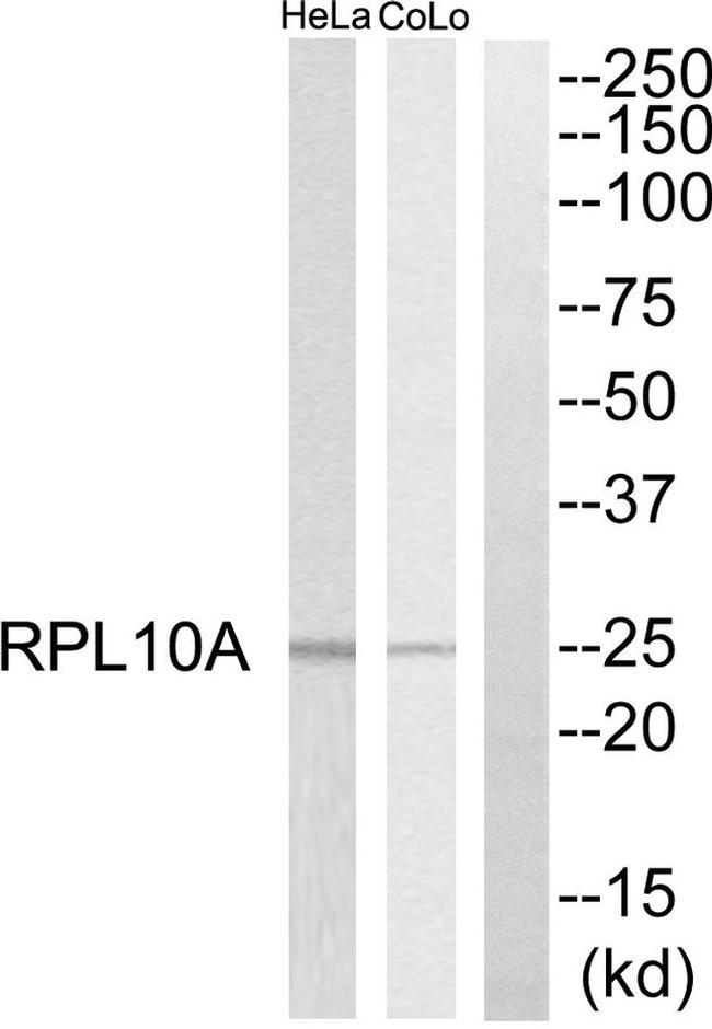 RPL10A Antibody in Western Blot (WB)