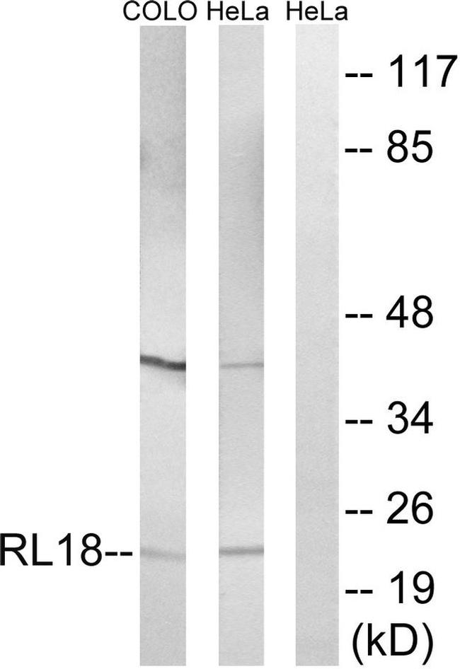 RPL18 Antibody in Western Blot (WB)