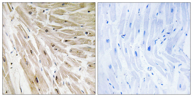 RPL22 Antibody in Immunohistochemistry (Paraffin) (IHC (P))