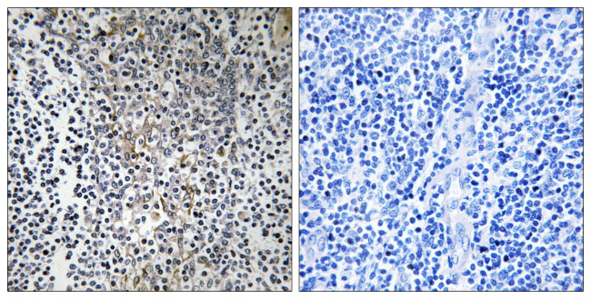 RPL23 Antibody in Immunohistochemistry (Paraffin) (IHC (P))