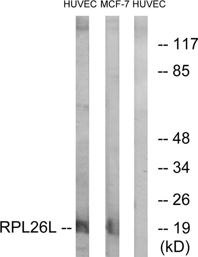 RPL26L1 Antibody in Western Blot (WB)