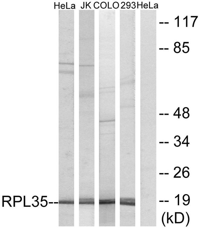 RPL35 Antibody in Western Blot (WB)