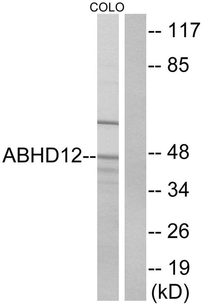 ABHD12 Antibody in Western Blot (WB)