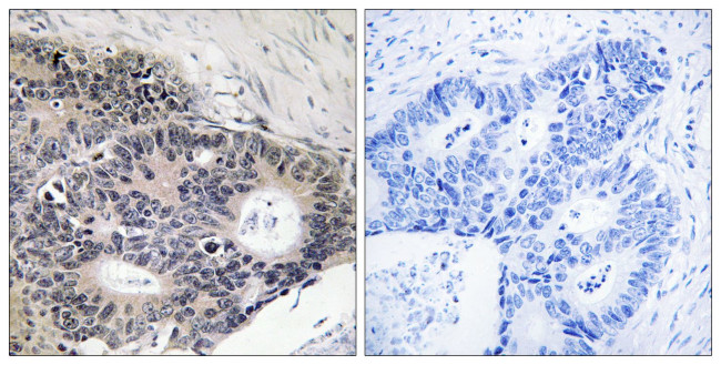 ABHD12B Antibody in Immunohistochemistry (Paraffin) (IHC (P))