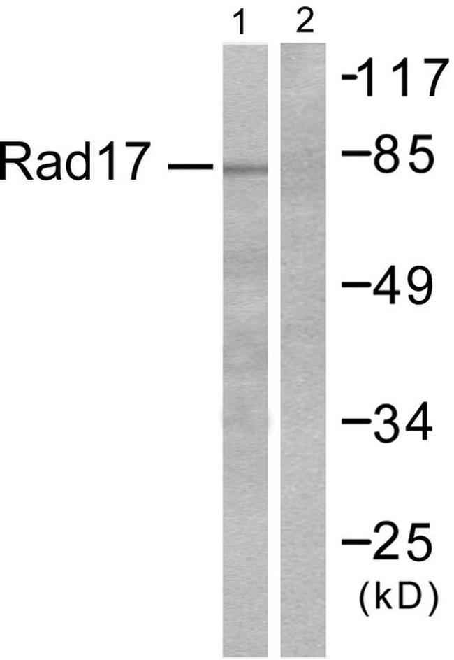 ABHD14A Antibody in Western Blot (WB)