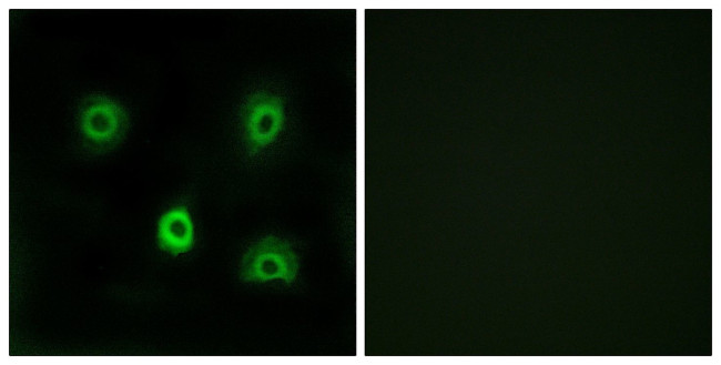 ABHD6 Antibody in Immunocytochemistry (ICC/IF)
