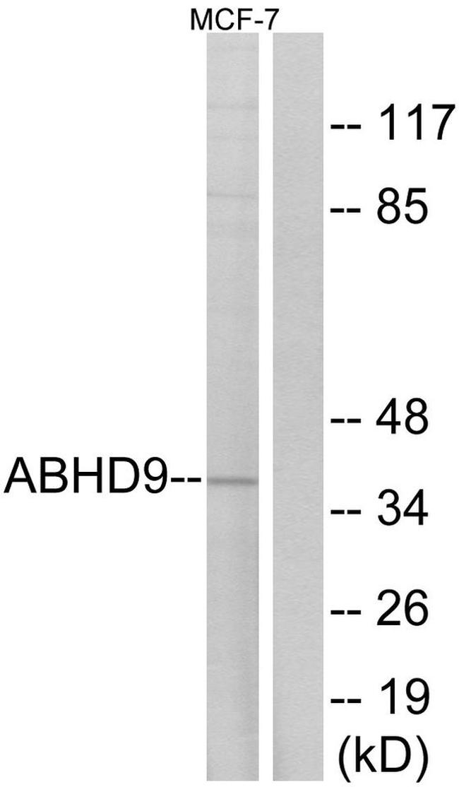 ABHD9 Antibody in Western Blot (WB)