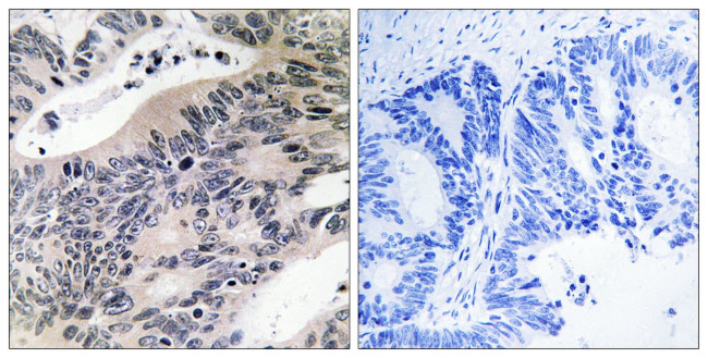 ACSS1 Antibody in Immunohistochemistry (Paraffin) (IHC (P))