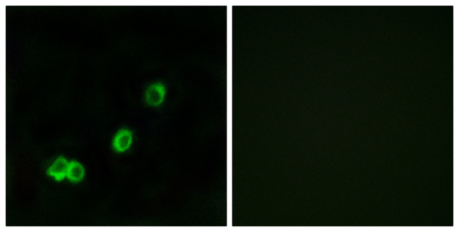 ACOT1 Antibody in Immunocytochemistry (ICC/IF)