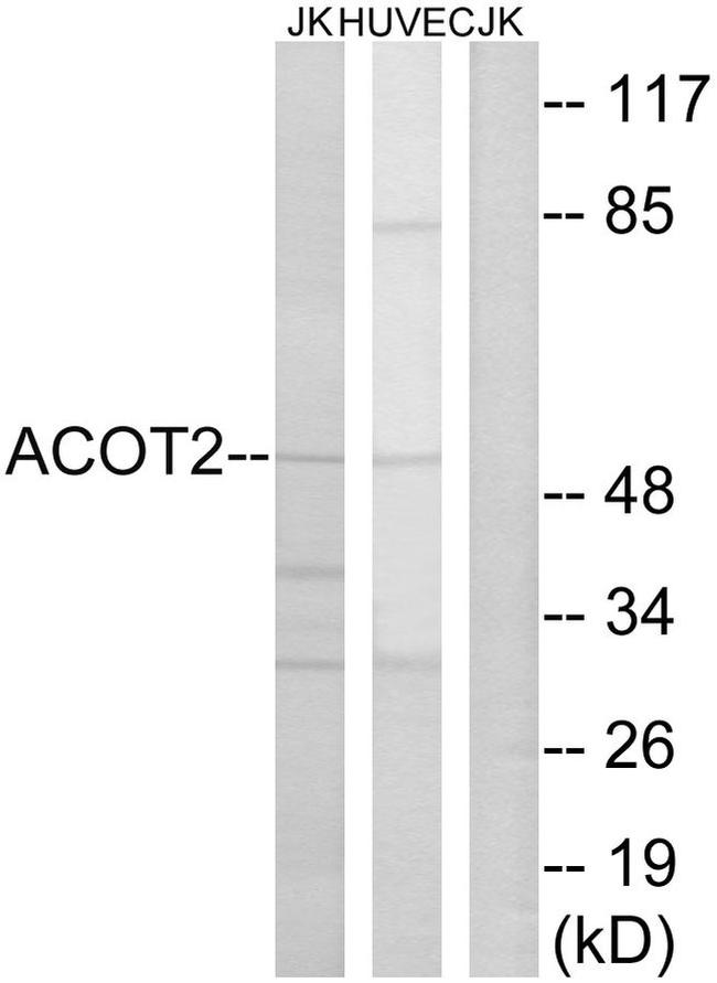 ACOT2 Antibody in Western Blot (WB)
