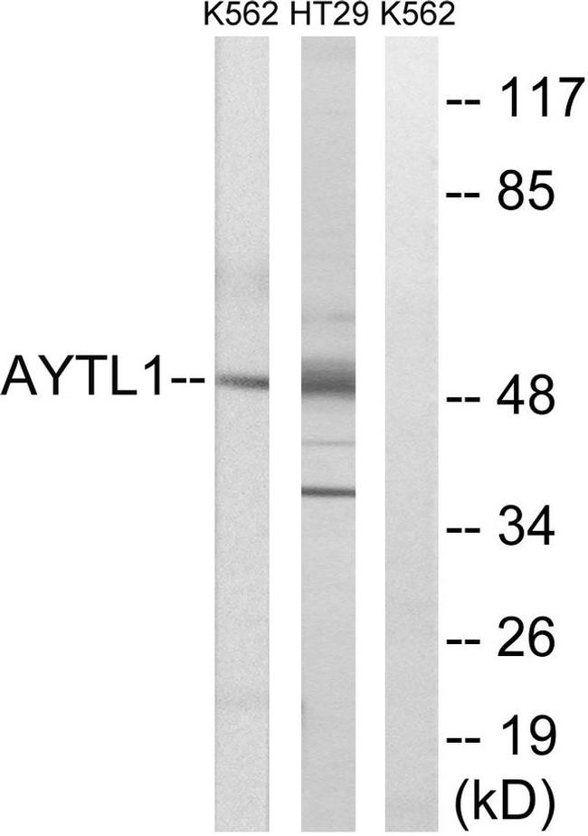 LPCAT2 Antibody in Western Blot (WB)