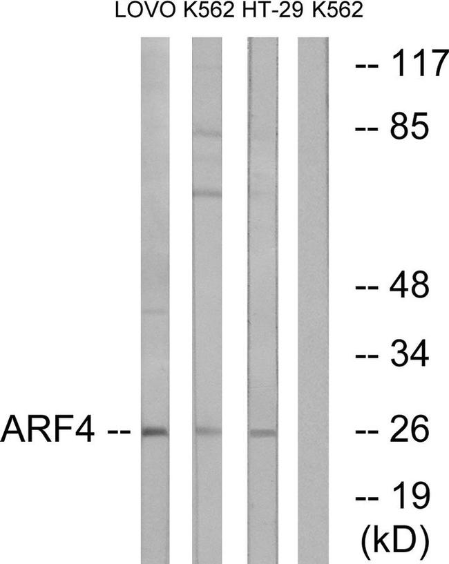ARF4 Antibody in Western Blot (WB)