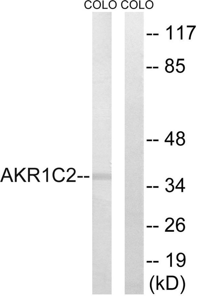AKR1C2 Antibody in Western Blot (WB)