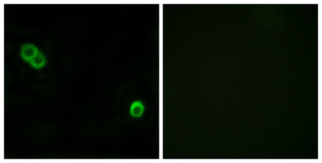ACER3 Antibody in Immunocytochemistry (ICC/IF)