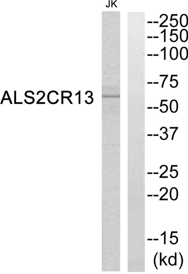 FAM117B Antibody in Western Blot (WB)