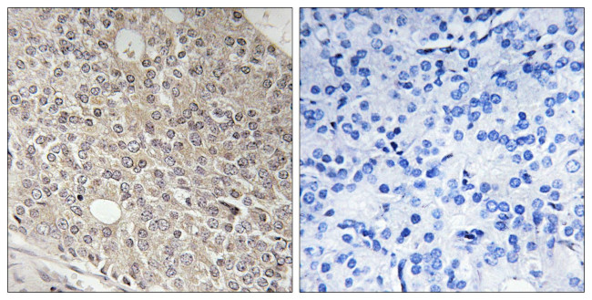 AMOTL1 Antibody in Immunohistochemistry (Paraffin) (IHC (P))