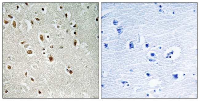 A20A3 Antibody in Immunohistochemistry (Paraffin) (IHC (P))