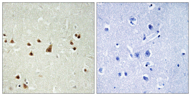 ANKRD26 Antibody in Immunohistochemistry (Paraffin) (IHC (P))