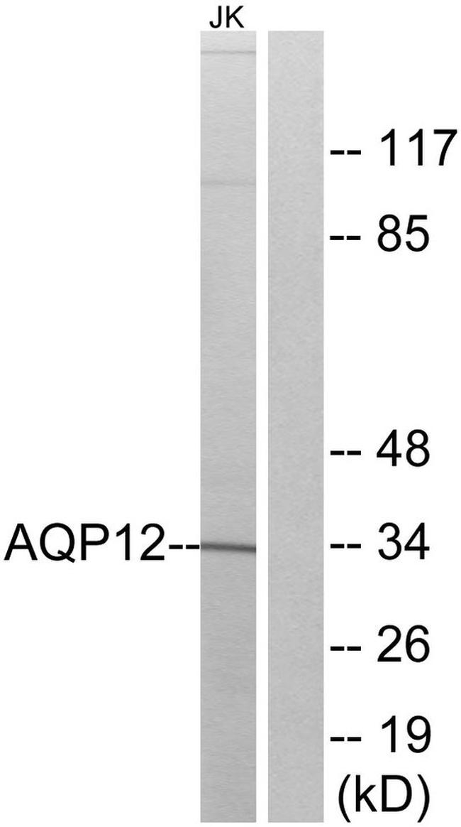 Aquaporin 12 Antibody in Western Blot (WB)
