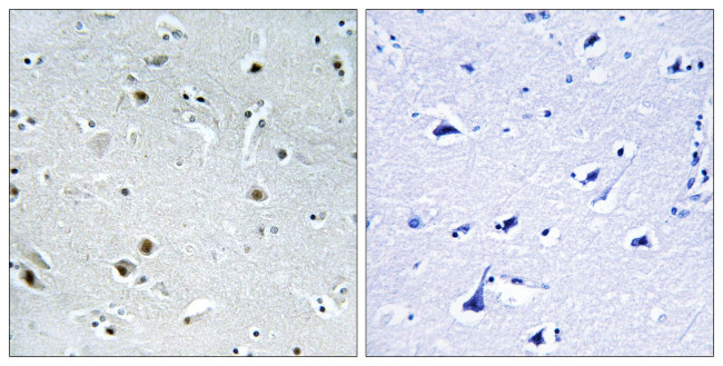 DDX24 Antibody in Immunohistochemistry (Paraffin) (IHC (P))