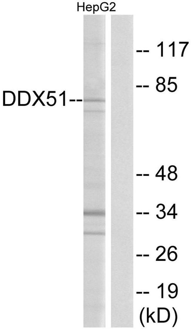 DDX51 Antibody in Western Blot (WB)