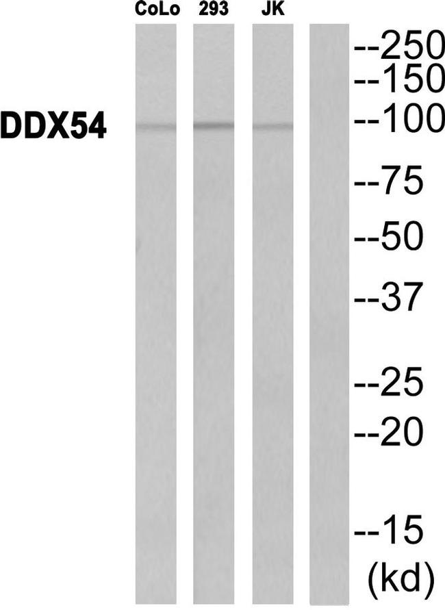 DDX54 Antibody in Western Blot (WB)