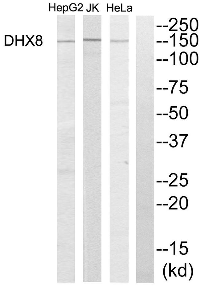 DHX8 Antibody in Western Blot (WB)