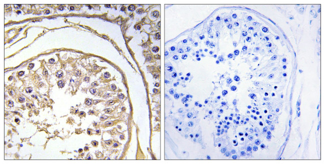 BAGE2 Antibody in Immunohistochemistry (Paraffin) (IHC (P))