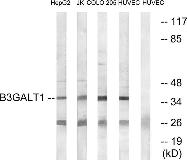 B3GALT1 Antibody in Western Blot (WB)