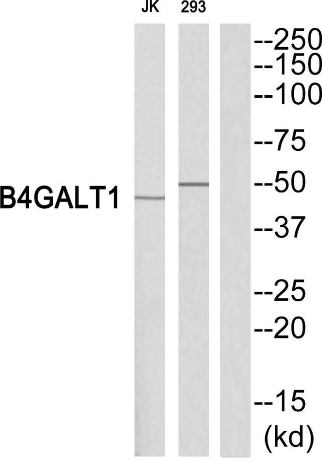B4GALT1 Antibody in Western Blot (WB)