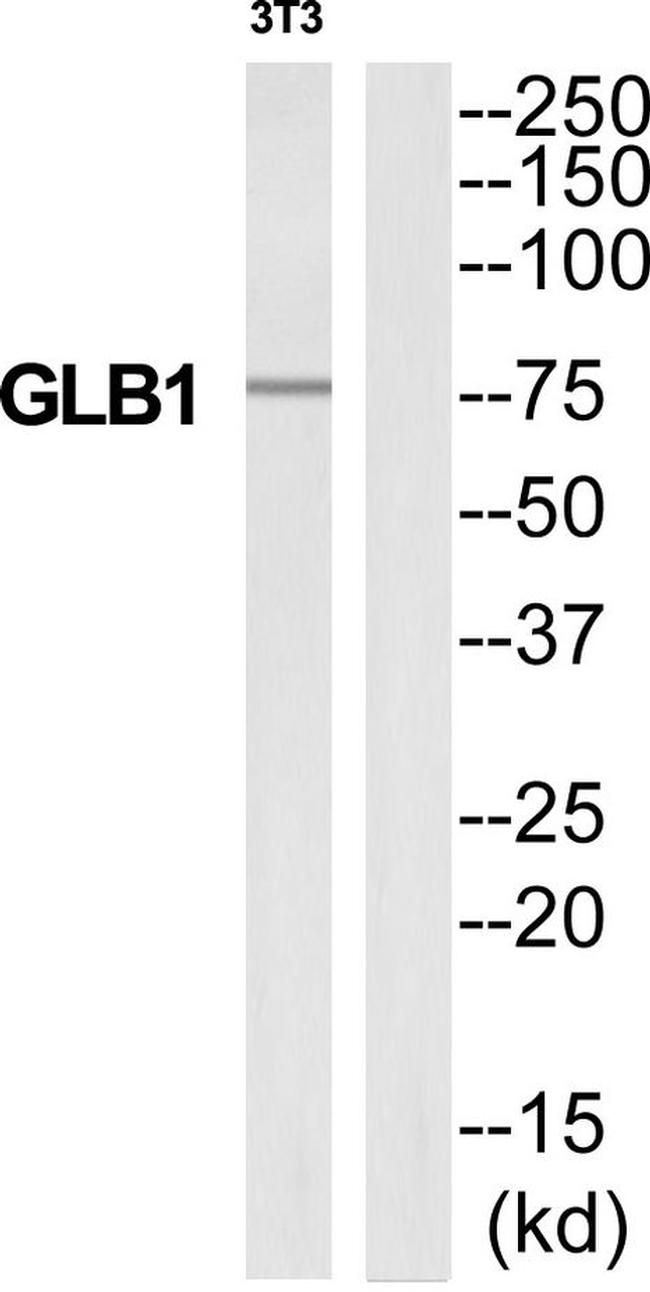 beta Galactosidase Antibody in Western Blot (WB)