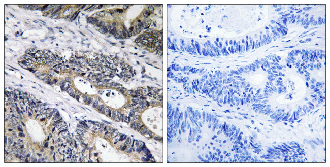 GLB1L3 Antibody in Immunohistochemistry (Paraffin) (IHC (P))