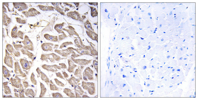 BRWD3 Antibody in Immunohistochemistry (Paraffin) (IHC (P))