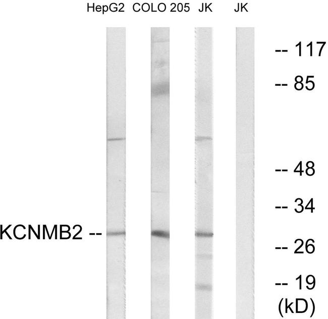 KCNMB2 Antibody in Western Blot (WB)