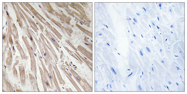 ARPP21 Antibody in Immunohistochemistry (Paraffin) (IHC (P))