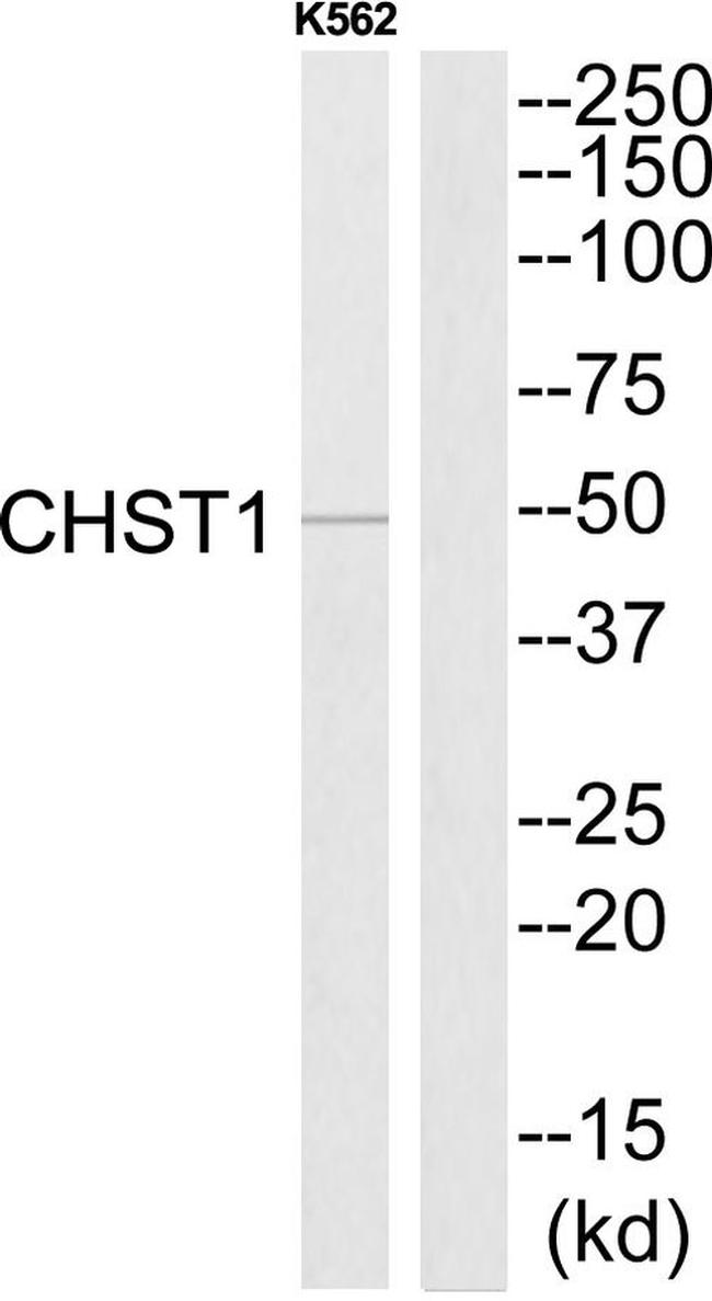CHST1 Antibody in Western Blot (WB)