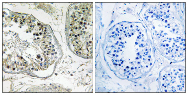 CHST13 Antibody in Immunohistochemistry (Paraffin) (IHC (P))