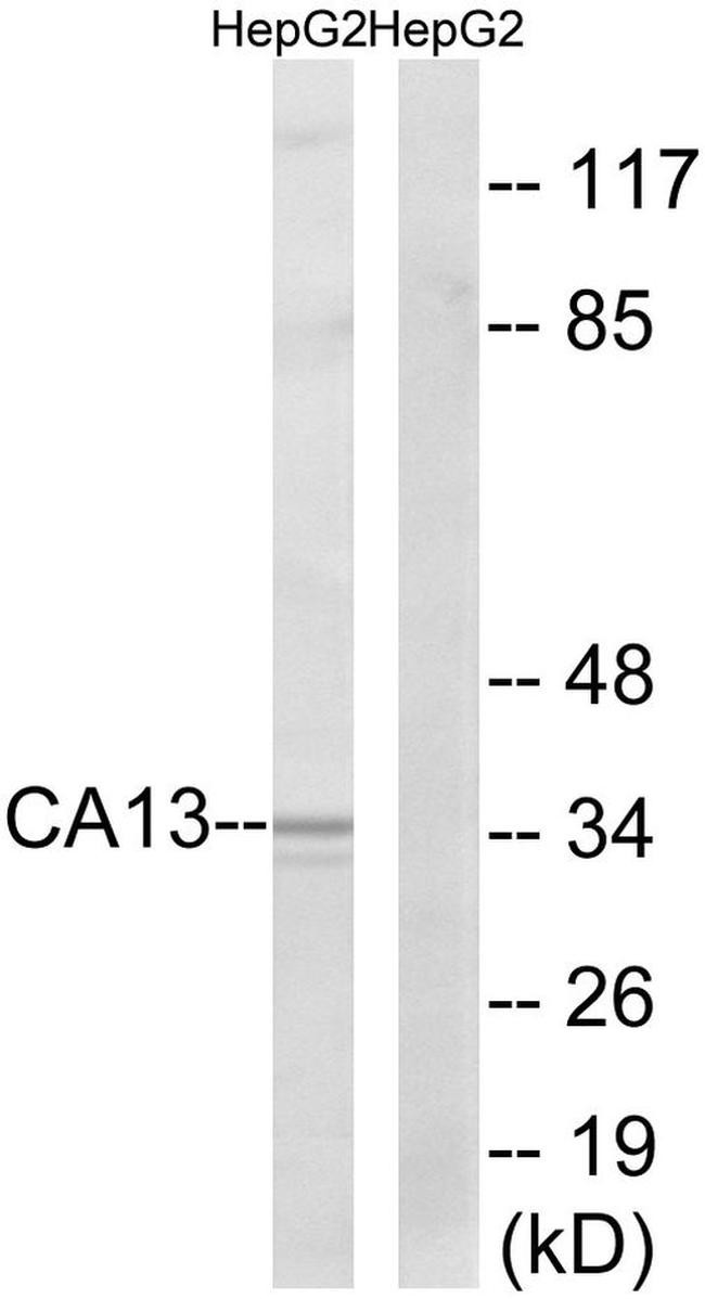 Carbonic Anhydrase XIII Antibody in Western Blot (WB)