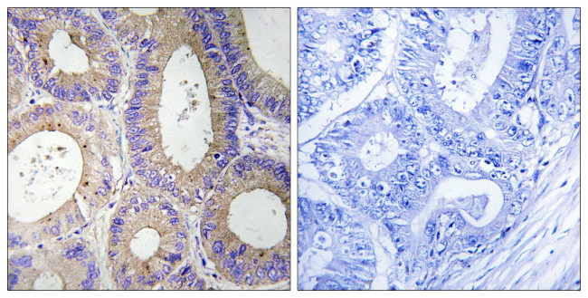 CBR3 Antibody in Immunohistochemistry (Paraffin) (IHC (P))
