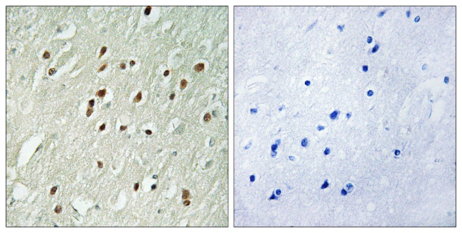 CNTROB Antibody in Immunohistochemistry (Paraffin) (IHC (P))