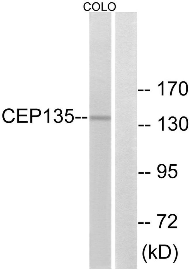 CEP135 Antibody in Western Blot (WB)