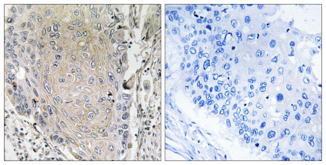 Cerebellin 3 Antibody in Immunohistochemistry (Paraffin) (IHC (P))