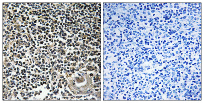 Cerebellin 4 Antibody in Immunohistochemistry (Paraffin) (IHC (P))