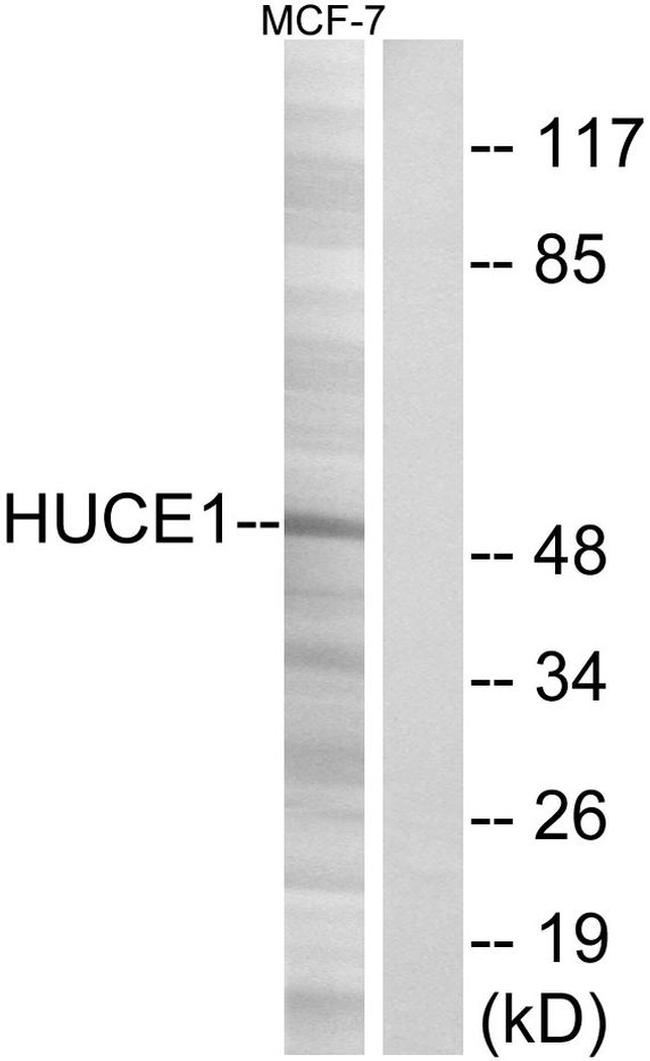 Cerebral Protein 1 Antibody in Western Blot (WB)