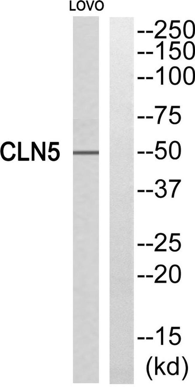CLN5 Antibody in Western Blot (WB)