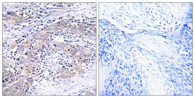 CLN6 Antibody in Immunohistochemistry (Paraffin) (IHC (P))
